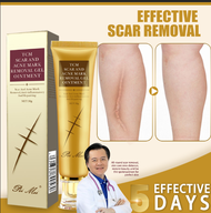 fix scar removal original scar remover for old scar on leg revi cream scars removal all types scar r