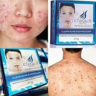 Edikal's Secret Clear Acne & scar Enzyme Soap EDIKAL ESW EXTRA SKIN WHITE ( Enzyme Acne Soap 1 )