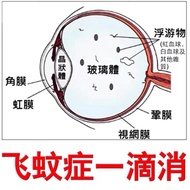 eye dropJin Shi Jian  eye cold compress gel 13ml drops Cool Eye Drops Medical Cleanning Eyes Detox Relieves Fatigueeye drops for dry eyes Personal Optical Care清凉眼药水医用清洁眼睛排毒舒缓疲劳放松按摩金视健快