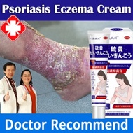 SG stock!! Japan antifungal cream eczema cream itchy skin cream Ointment For Itchy Skin Quick Relief