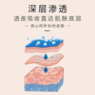 Acne Removal Cream Repair Acne Marks Acne Acne Acne Cream Plant Acne Removal Acne Closed Mouth Cream