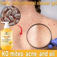 Sulfur shower gel, acne shower gel, anti mite, eczema, urticaria, red rash, mosquito repellent, clea