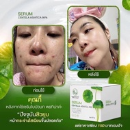 SERUM CENTELLA ASIATICA 98% facial serum