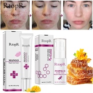 ❍❀  Mango Acne Cream Propolis Repair Acne Serum Brightening Skin Acne Scar Spots Acne Treatment Serum Acne Removal Invisible Patches