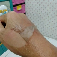 KEM4RI. Peeling Gel 25% - Peeling tca - Peeling Badan - Pengelupasan - Pemutih