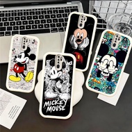 DN14 Mickey Mouse hp Plating Casing for Realme Reno Narzo C25Y A15s C12 C11 A16K A15 20 C21 C20 C25S