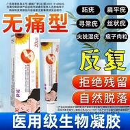 Medical Warts Removal Dedicated Sunflower Warts Removal Cream Flat Ordinary Warts Sharp Wet Warts Fi