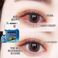 Eye Drops for CATARAL EYE WASH DRY EYES DROPS CLEANER | ItCHy Eyes | Glaucoma | Bloodshot | Sore Eye