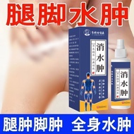 Hot Sale Remove Lower Limbs Edema] Legs Foot Floating Edema Reduce Swelling Foot Edema Reduce Edema 