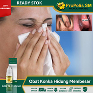 Obat Konka Hidung Membesar Obat Pembengkakan Konka Hidung Obat Konka Hidung Bengkak Obat Untuk Menge