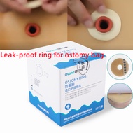 10pcs colostomy bag leak-proof ring ointment stoma ring stoma care protection skin stoma ring bottom plate