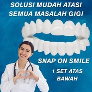 Terlaris IDEAL SMILE GIGI PALSU ATAS BAWAH GIGI PALSU INSTAN LEPAS PASANG VENEER GIGI