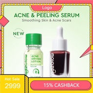 G-2-G Acne Serum Essence Drying Lotion Smooth Skin Brightening Skin Acid Dark Spot Acne-pron Blackhe