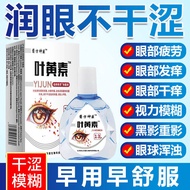 Lutein Eye Drop Eye Lotion Eye Care Lotion Relieve Eye Fatigue Dry Eye Drop AG602 #.