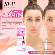 Suv Skincare | Acne SERUM