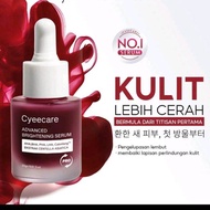 Cyeecare Advance Brightening Peeling Serum