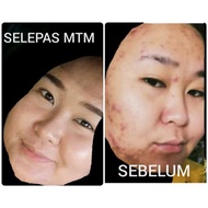 Cream Scars Whitening Magic Tamarind Mask Yusiqa Beauty