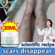 leave no trace EELHOE scar removal cream scar cream acne scar removal cream Root removal removal cre