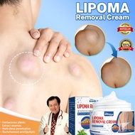 Obat Benjolan Lipoma Salep Lipoma Removal Cream Herbal/Fibroid/Benjolan Subkutan/Leher Benjolan/Pung