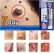 Warts Remover Warts Remover Original Mole And Warts Remover Kasoy Cream Warts Remover Legit Warts Re