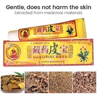 Krim Gatal Panau Kulit Anti Itchy Cream Antibacterial Ointment Eczema Cream Ringworm Krim Untuk Ecze