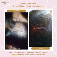 Hair Tonic FF Rm65.00