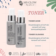 MS GLOW Toner - Toner Glowing MS Glow - Toner Acne MS Glow - MS Glow