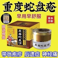 Herpes zoster, snake disc sore ointment, herpes zoster, post-herpetic neuralgia, sn带状疱疹蛇盘疮药膏带状泡疹后遗神经