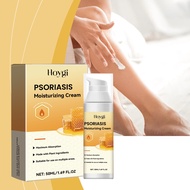 Hoygi Psoriasis Cream 50ml Antifungal Cream Eczema Cream Cream Gatal Kulit Krim Gatal Kulit