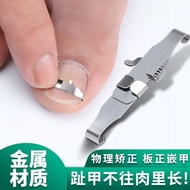 Parony correctionOL Paronychia Nail Corrector Nail inlay Nail inlay Curling Nail Special Pliers Pedi
