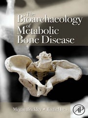 The Bioarchaeology of Metabolic Bone Disease Rachel Ives