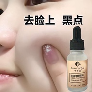 祛痣祛斑点痣药水美白脸部无痕修复去黑痣膏神器祛斑霜精华液Nevus removing and spot removing lotion Whitening face, no trace repair,