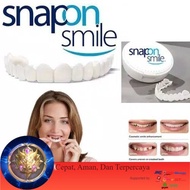 snap on smile venner gigi original