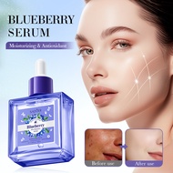 Sadoer Antioxidant essence Full English essence essence Blueberry Hyaluronic Acid Hyaluronic 4MM1