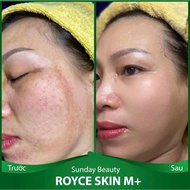 [SKIN Peel] ROYCE SKIN M+ SKIN Peel Comprehensive peeling SKIN peel c20