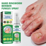 Fresh Odor Protection Foot Care Athletes Foot Deodorant Spray Cleansing Mist 30ml