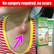 100% Authentic Japanese imported lipoma removal cream Herbal lipoma removal cream 20g Original Quick