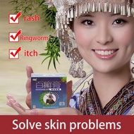 ❤️SG Stock❤️ 百癣膏 Baixuangao cream Psoriasis ointment Ringworm Eczema Itch relief herbal cream Bai xian gao shu li jia