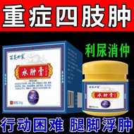 Lower limb edema ointment, edema of the elderly, edema of th Lower limb Edema Cream Small Legs Foot 
