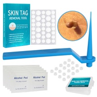 2 IN 1 Auto Skin Tag Remover Kit Micro Skin Tag อุปกรณ์กำจัดผู้ใหญ่ Mole Stain Wart Remover Face Care Beauty Tools