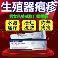 生殖男女器疱疹带状疱疹病毒引起感染脓包水泡瘙痒膏Genital and male genital herpes herpes zoster virus infection pustules blist