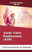 Aortic Valve Replacement (AVR): A Survival Guide for Patients
