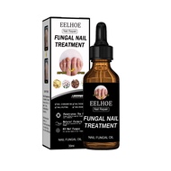 Eelhoe Nail Repair Solution Antibacerial Nail Fungus Treatment Nail Repair Liquid Paronychia Nail Re