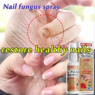 ◊☜ ๑ ♞️️Bonil Anti Fungal Solution 50ml Nail Repair Nail Fungal Treatment Anti-fungal Care Set Tool