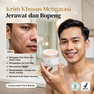 Powerful Night Cream Acne Remover acne scar remover Bpom acne scar remover acne scar remover acne sp
