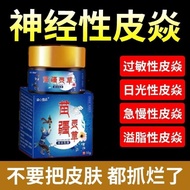 Salep herbal asli Miaojiang,psoriasis,tinea corporis, tinea pedis,tinea manuum, peradangan kulit, ek