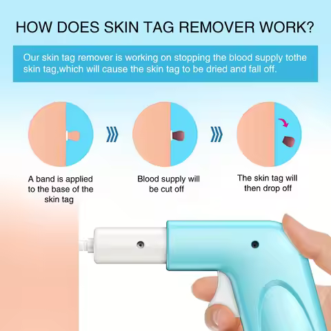 Mole Removal Kit 3 In 1 Skin Warts Removal Kit Auto Skin Tags Remover Pen Painless Skin Tag Mole War