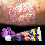 Skin Fungus Ointment Eczema Ointment Most Powerful Itching Ointment 30g Scalp Psoriasis Hand Tinea Foot Odor Versioncolor Inhibits Dermatitis Anti-Fungal Anti-Itch Cream Inhibits Dermatitis Anti-Fungal Anti-Itch Cream