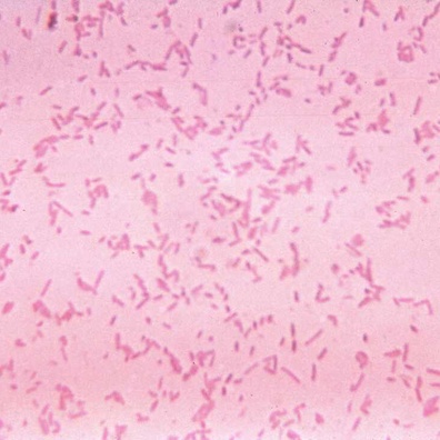 Terapi Faj Muncul sebagai Potensi Jawapan kepada Krisis Rintangan Antibiotik
