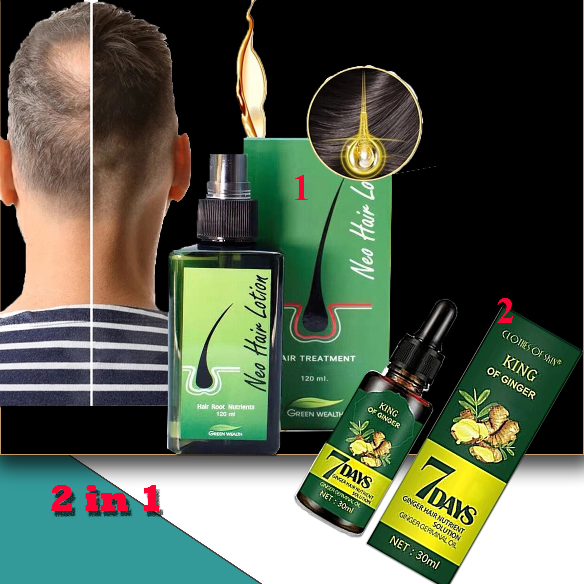 Neo Hair Lotion Original Spray Price & Promotion-Mar 2023|BigGo Malaysia
